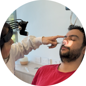 Cauterización nasal